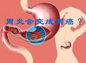 ����θ�����Ʒ���